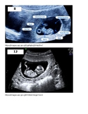 Baby is the size of.... Ultrasound photos/Size matched foods